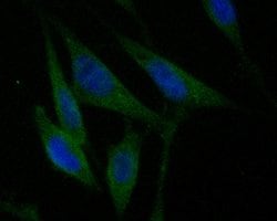 Invitrogen CHRNB2 Polyclonal Antibody 100 &mu;L; Unconjugated:Antibodies,