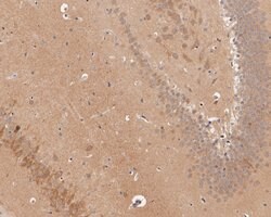 Invitrogen CHRNB2 Polyclonal Antibody 100 &mu;L; Unconjugated:Antibodies,