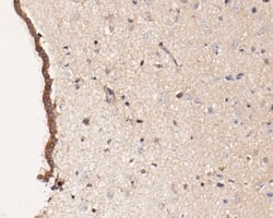 Invitrogen PICK1 Polyclonal Antibody 100 &mu;L; Unconjugated:Antibodies,