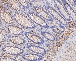 Invitrogen PICK1 Polyclonal Antibody 100 &mu;L; Unconjugated:Antibodies,