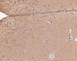 Invitrogen PICK1 Polyclonal Antibody 100 &mu;L; Unconjugated:Antibodies,