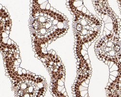 PHR2 Polyclonal Antibody, Invitrogen 100 &mu;L; Unconjugated:Antibodies,