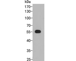 PHR2 Polyclonal Antibody, Invitrogen 100 &mu;L; Unconjugated:Antibodies,