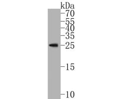 Invitrogen RAB27B Polyclonal Antibody 100 μL; Unconjugated:Antibodies,
