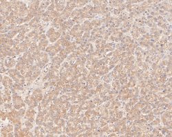 Invitrogen GBP2 Polyclonal Antibody 100 &mu;L; Unconjugated:Antibodies,