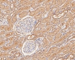 Invitrogen GBP2 Polyclonal Antibody 100 &mu;L; Unconjugated:Antibodies,