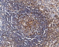 Invitrogen CD35 Polyclonal Antibody 100 &mu;L; Unconjugated:Antibodies,