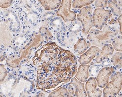 Invitrogen CD35 Polyclonal Antibody 100 &mu;L; Unconjugated:Antibodies,