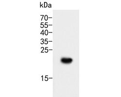 Invitrogen CD35 Polyclonal Antibody 100 &mu;L; Unconjugated:Antibodies,