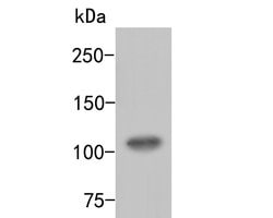 Invitrogen ARF16 Polyclonal Antibody 100 &mu;L; Unconjugated:Antibodies,
