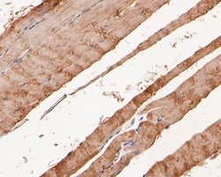 Invitrogen KCNQ4 Polyclonal Antibody 100 &mu;L; Unconjugated:Antibodies,
