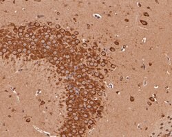 Invitrogen KCNQ4 Polyclonal Antibody 100 &mu;L; Unconjugated:Antibodies,