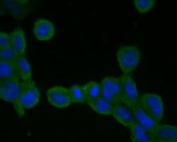 Invitrogen ADAM22 Polyclonal Antibody 100 &mu;L; Unconjugated:Antibodies,