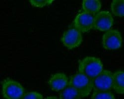Invitrogen ADAM22 Polyclonal Antibody 100 &mu;L; Unconjugated:Antibodies,