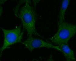 Invitrogen ADAM22 Polyclonal Antibody 100 &mu;L; Unconjugated:Antibodies,