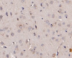 Invitrogen ADAM22 Polyclonal Antibody 100 &mu;L; Unconjugated:Antibodies,