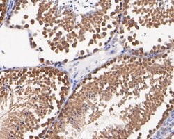 Invitrogen DTNBP1 Polyclonal Antibody 100 &mu;L; Unconjugated:Antibodies,