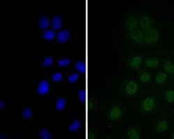 Invitrogen p16INK4a Polyclonal Antibody 100 &mu;L; Unconjugated:Antibodies,