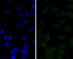Invitrogen p16INK4a Polyclonal Antibody 100 &mu;L; Unconjugated:Antibodies,