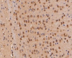 Invitrogen p16INK4a Polyclonal Antibody 100 &mu;L; Unconjugated:Antibodies,