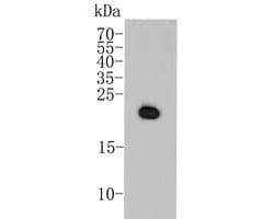 Invitrogen p16INK4a Polyclonal Antibody 100 &mu;L; Unconjugated:Antibodies,