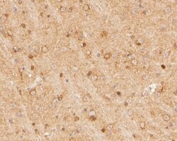 Invitrogen SYNDIG1 Polyclonal Antibody 100 &mu;L; Unconjugated:Antibodies,