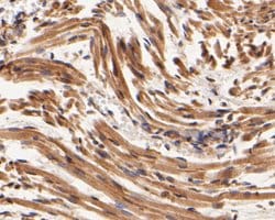 Invitrogen SYNDIG1 Polyclonal Antibody 100 &mu;L; Unconjugated:Antibodies,