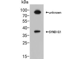 Invitrogen SYNDIG1 Polyclonal Antibody 100 &mu;L; Unconjugated:Antibodies,