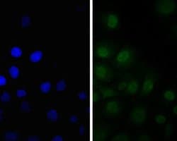 Invitrogen SSB Polyclonal Antibody 100 &mu;L | Buy Online | Invitrogen&trade; | Fisher Scientific