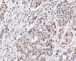 Invitrogen SSB Polyclonal Antibody 100 &mu;L | Buy Online | Invitrogen&trade; | Fisher Scientific