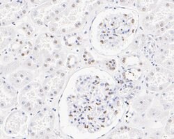 Invitrogen SSB Polyclonal Antibody 100 &mu;L | Buy Online | Invitrogen&trade; | Fisher Scientific