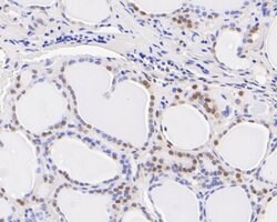 Invitrogen SSB Polyclonal Antibody 100 &mu;L | Buy Online | Invitrogen&trade; | Fisher Scientific