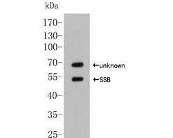 Invitrogen SSB Polyclonal Antibody 100 &mu;L | Buy Online | Invitrogen&trade; | Fisher Scientific