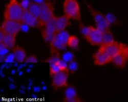 Invitrogen Zfp352 Polyclonal Antibody 100 &mu;L; Unconjugated:Antibodies,
