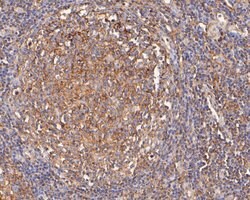 Invitrogen Apolipoprotein J Polyclonal Antibody 100 &mu;L | Buy Online | Invitrogen&trade; | Fisher Scientific