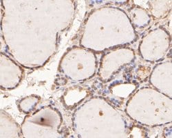 Invitrogen NAT13 Polyclonal Antibody 100 &mu;L; Unconjugated:Antibodies,