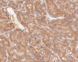Invitrogen KAP3 Polyclonal Antibody 100 μL; Unconjugated:Antibodies,