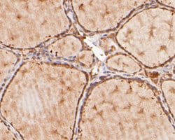 Invitrogen KAP3 Polyclonal Antibody 100 μL; Unconjugated:Antibodies,