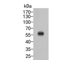 Invitrogen SERPINA6 Polyclonal Antibody 100 &mu;L | Buy Online | Invitrogen&trade; | Fisher Scientific