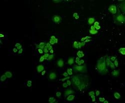 Invitrogen Ubiquitin Polyclonal Antibody 100 &mu;L; Unconjugated:Antibodies,