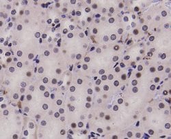 Invitrogen STAT1 alpha/beta Polyclonal Antibody 100 &mu;L | Buy Online | Invitrogen&trade; | Fisher Scientific