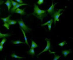 Invitrogen&trade;&nbsp;Desmin Polyclonal Antibody