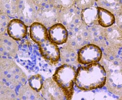 Invitrogen Catalase Polyclonal Antibody 100 &mu;L; Unconjugated:Antibodies,