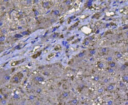 Invitrogen Catalase Polyclonal Antibody 100 &mu;L; Unconjugated:Antibodies,