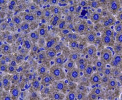 Invitrogen Catalase Polyclonal Antibody 100 &mu;L; Unconjugated:Antibodies,