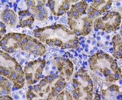 Invitrogen Catalase Polyclonal Antibody 100 &mu;L; Unconjugated:Antibodies,