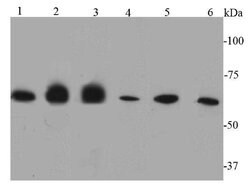 Invitrogen Catalase Polyclonal Antibody 100 &mu;L; Unconjugated:Antibodies,