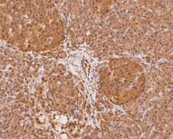 Invitrogen PSMA7 Polyclonal Antibody 100 &mu;L; Unconjugated:Antibodies,