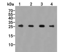 Invitrogen PSMA7 Polyclonal Antibody 100 &mu;L; Unconjugated:Antibodies,