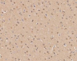 Invitrogen p21 ARC Polyclonal Antibody 100 &mu;L; Unconjugated:Antibodies,